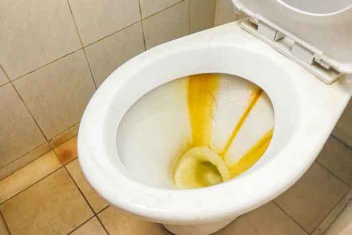 What Causes Yellow Stains On A Toilet Seat - White Plastic Toilet Seat Going Yellow