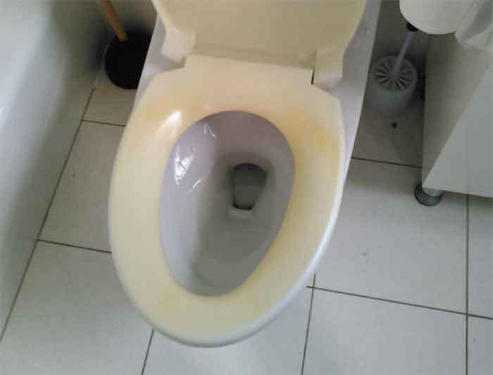 What Causes Yellow Stains On A Toilet Seat - White Plastic Toilet Seat Going Yellow