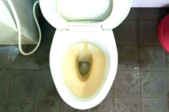 yellow-stains-toilet